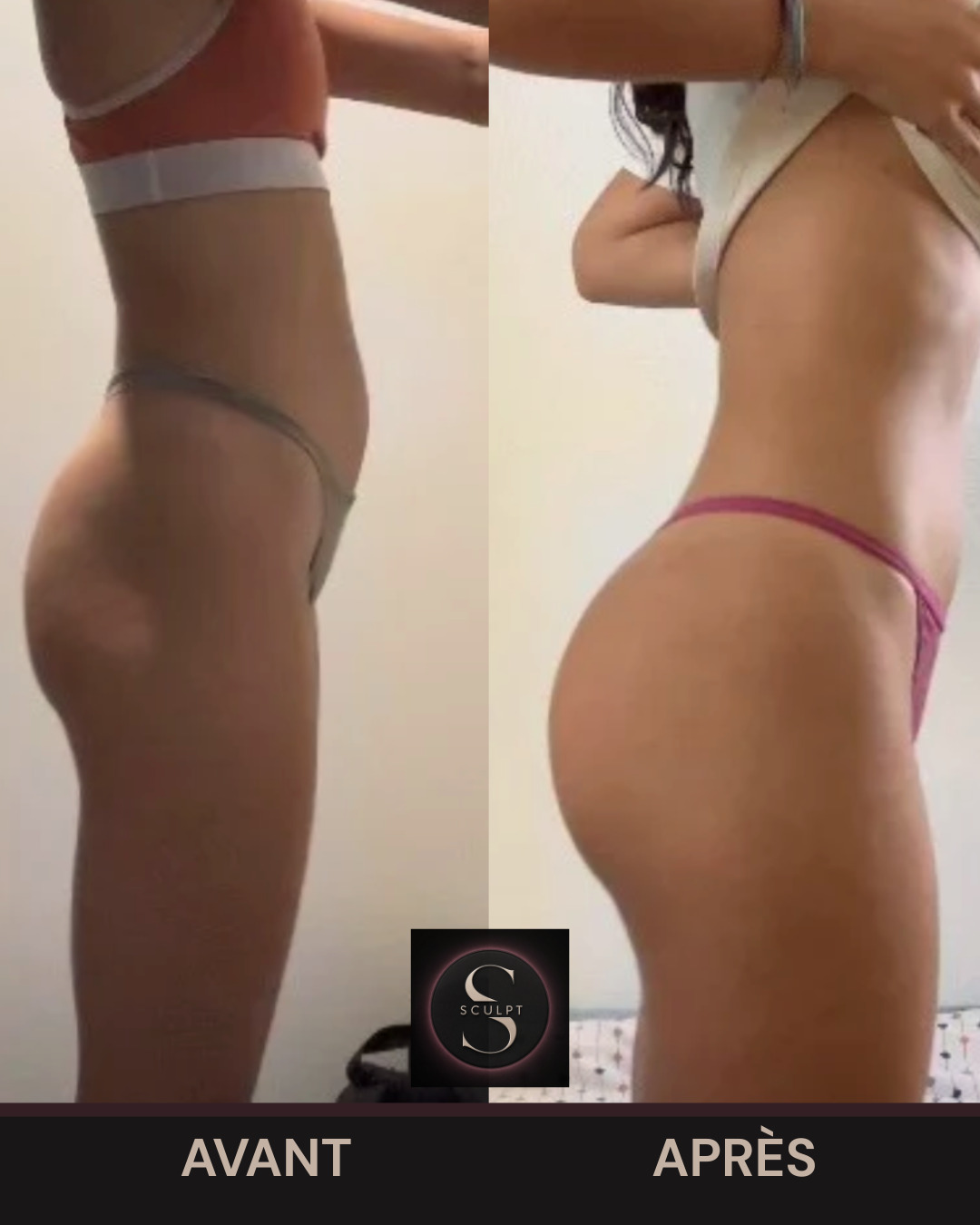 Transformation – Camille