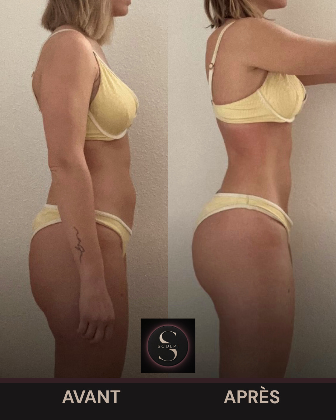 Transformation – Sarah