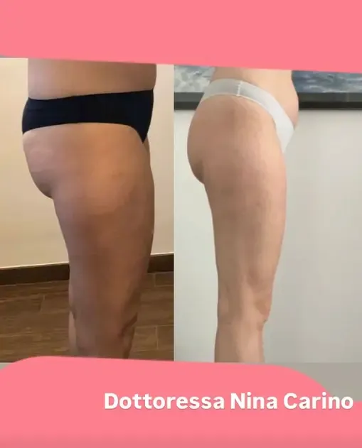 Testimonianza