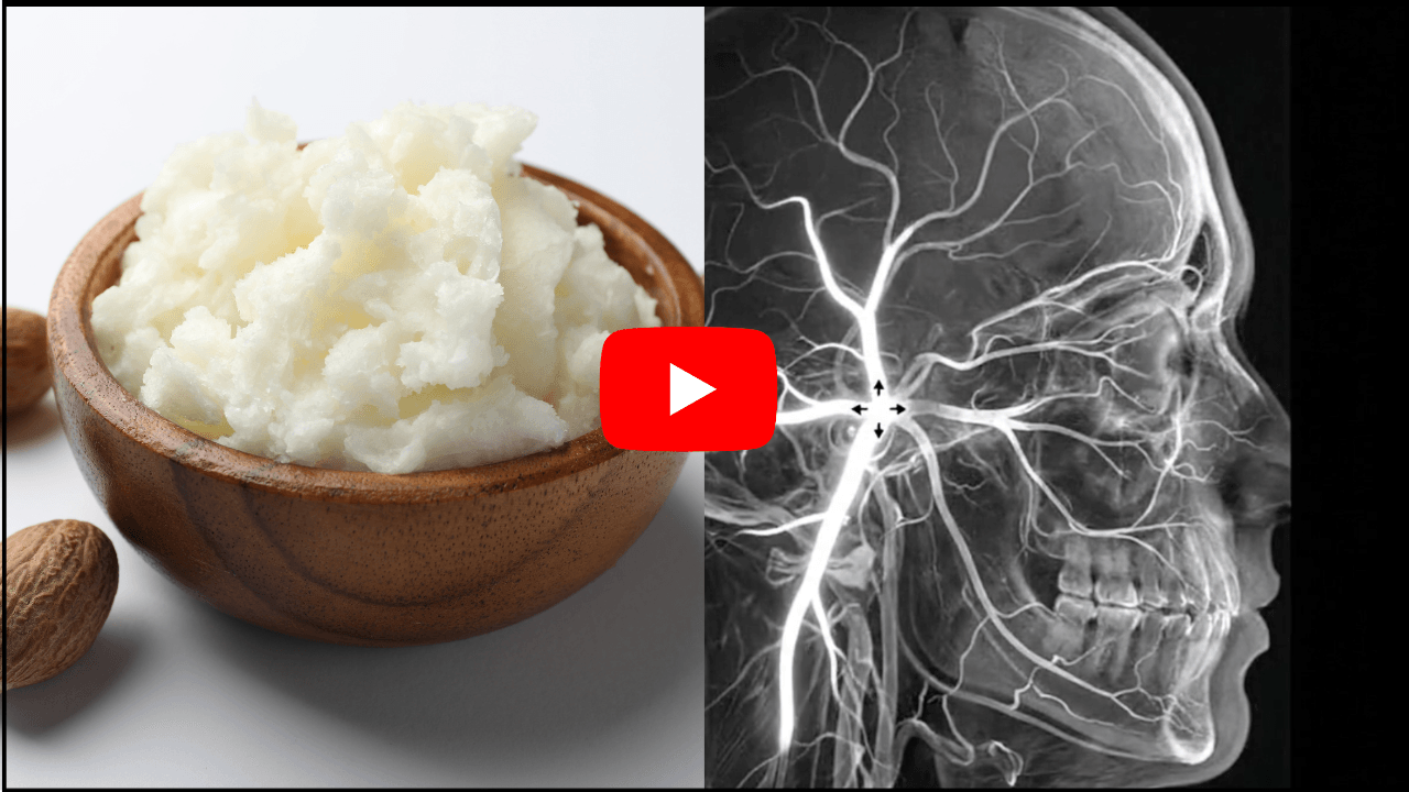 Arctic Brain Butter