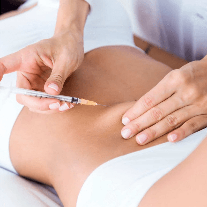 Mesoterapia