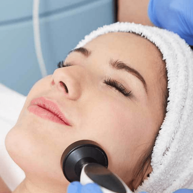 Radiofrecuencia Facial