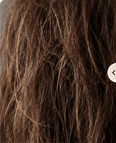 Dry, brittle brown hair