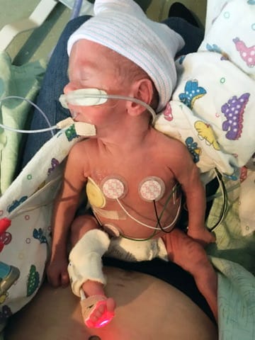 Kelli’s son as a premature newborn in the hospital