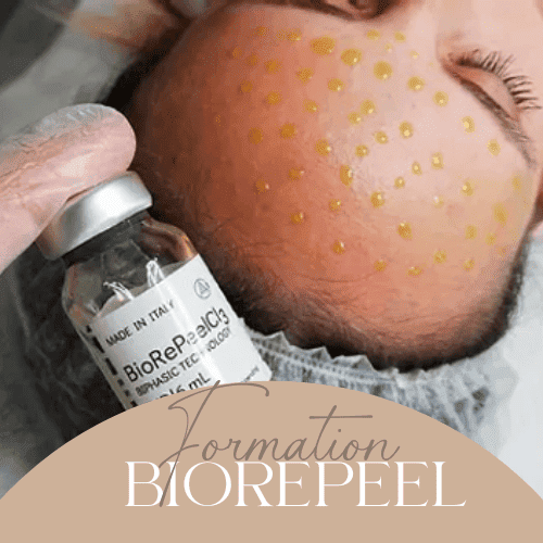 BioRePeel