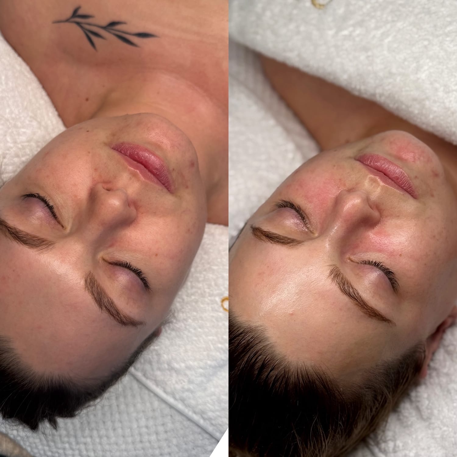 Résultat Hydraface