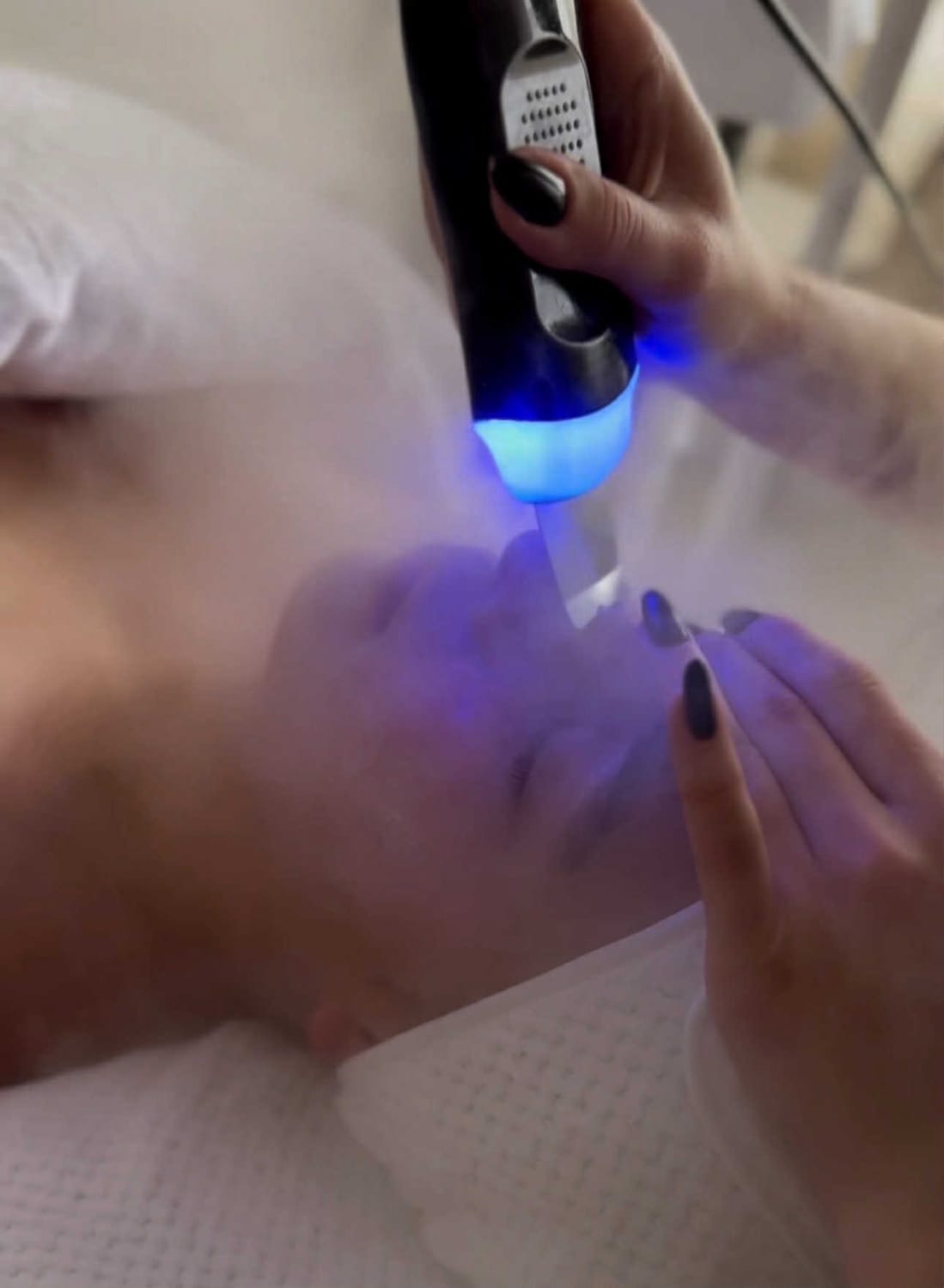 Technologie Hydraface