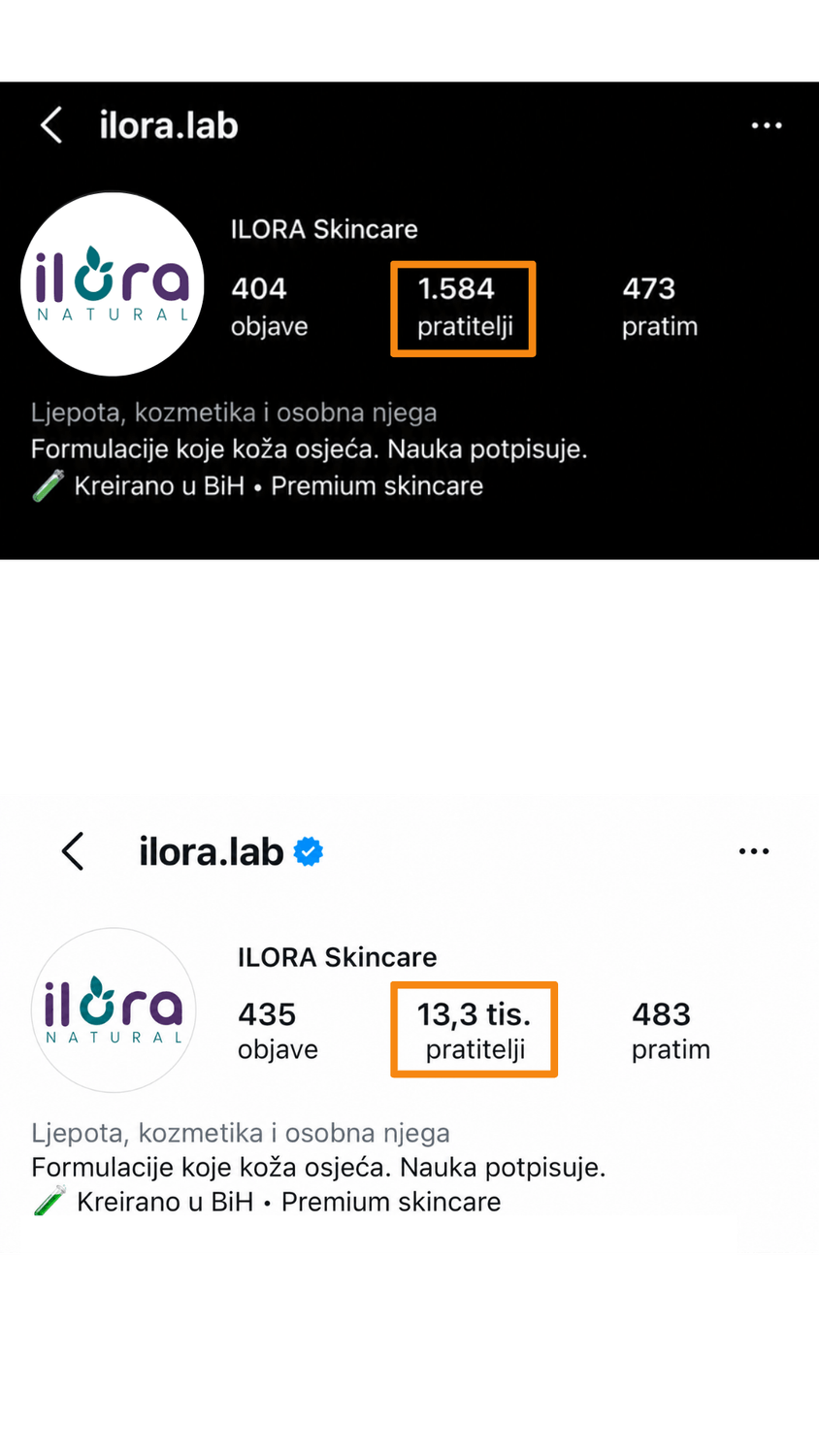 Rezultati - Ilora Skincare
