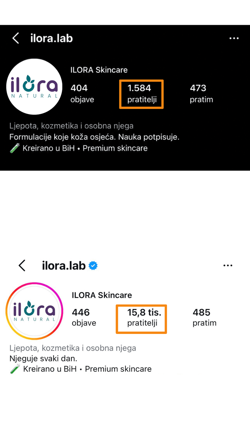 Rezultati - Ilora Skincare