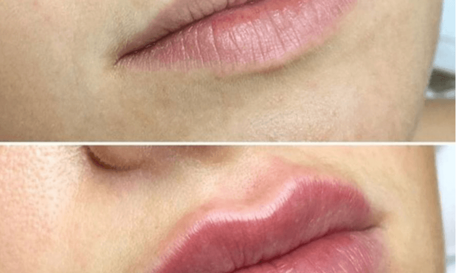 Formation Wonder Lips