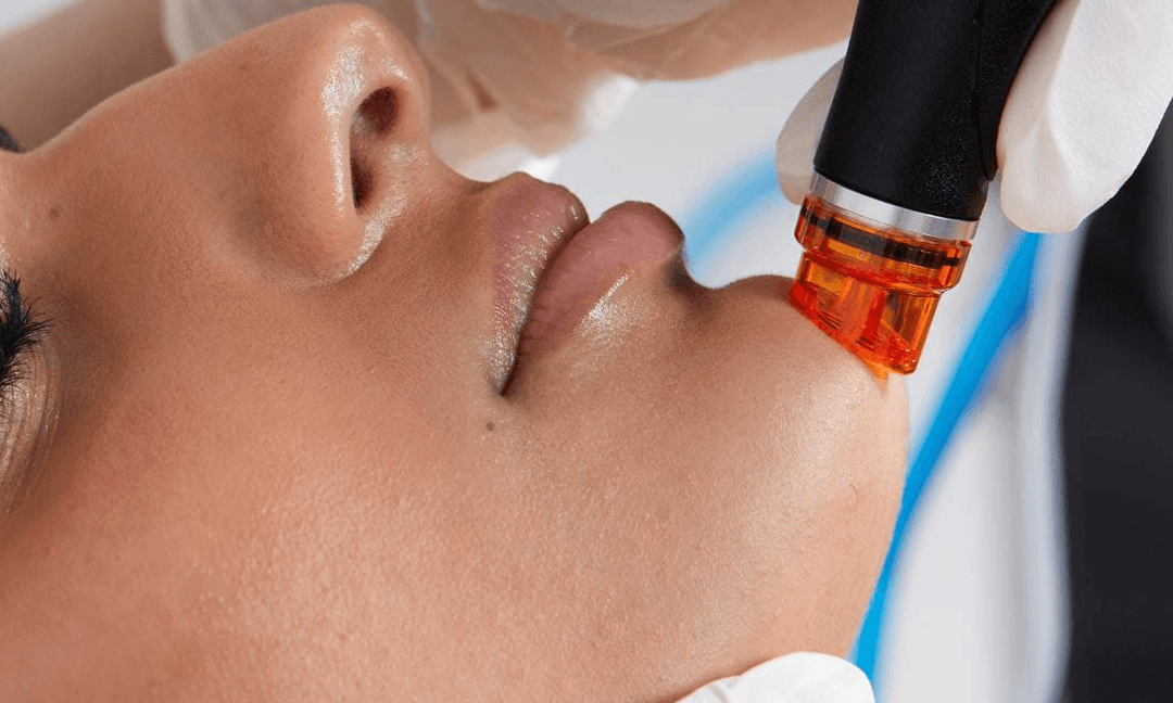 Formation Wonder Hydra