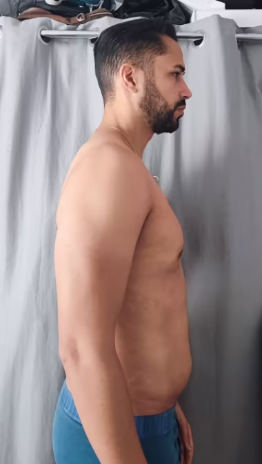 Thibault - après 30 jours