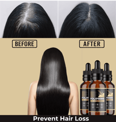 buy-foliprime