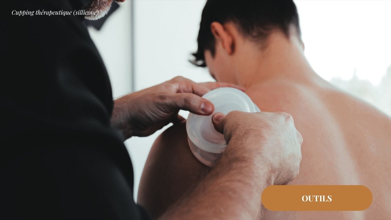 Cupping