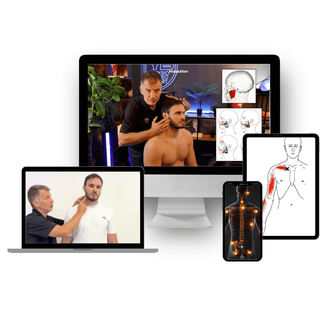 Formation Trigger Points — Yann Bourrel