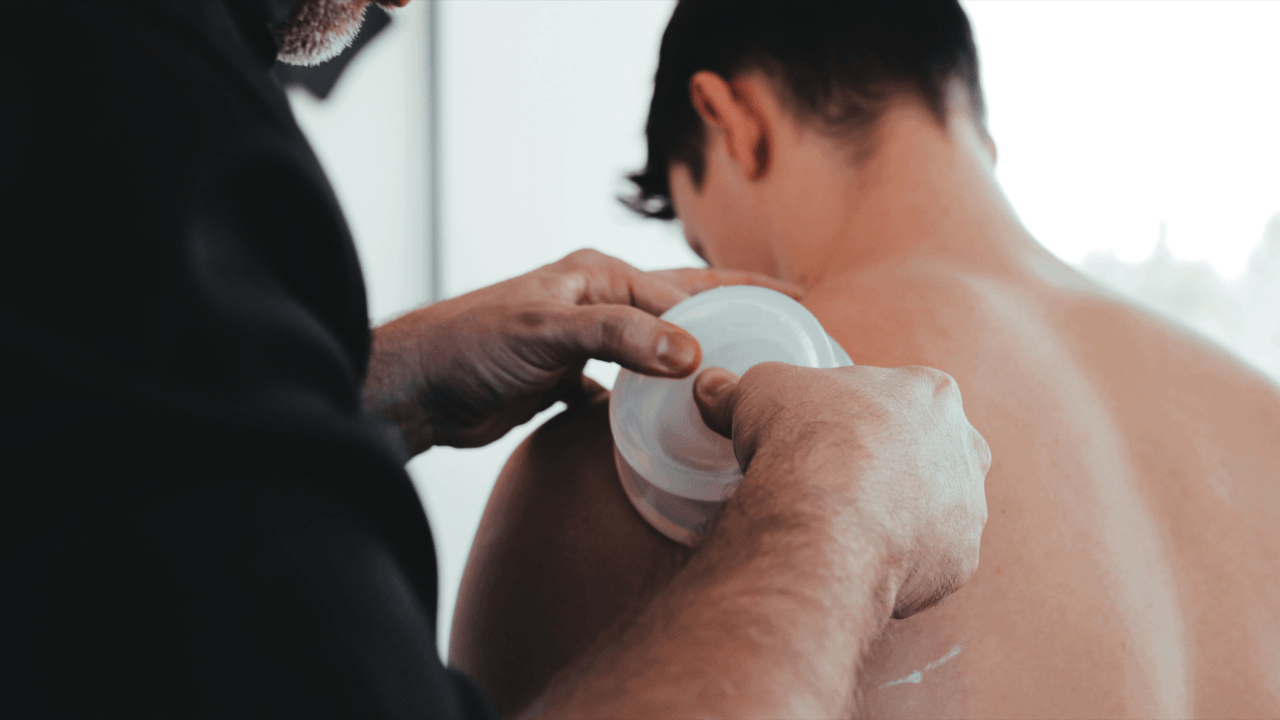 Cupping