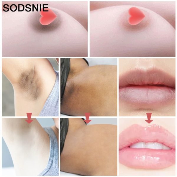 SODSNIE Intimate Area Whitening Cream