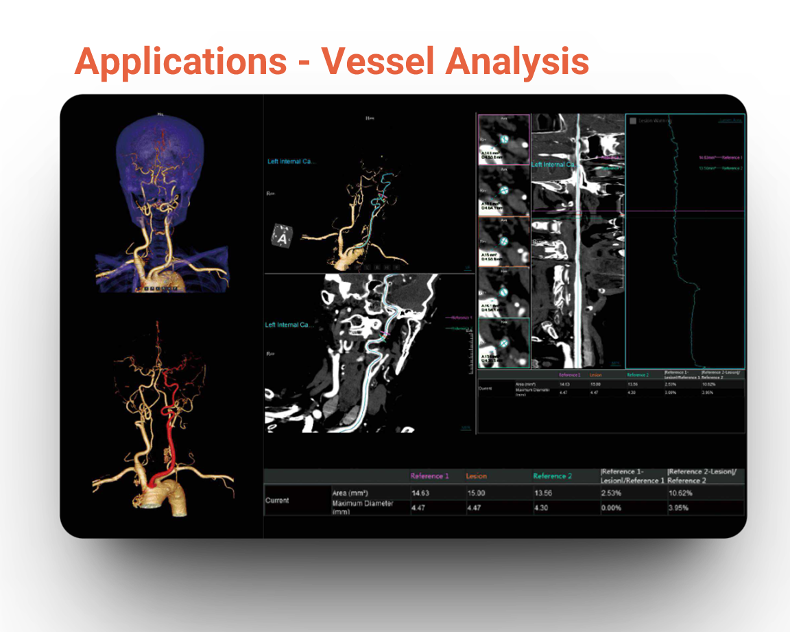 Applications - Vessel Analysis