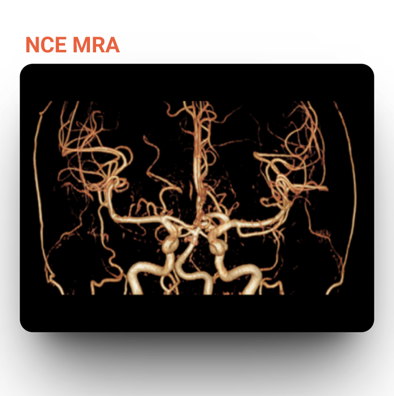 NCE MRA in uMR580