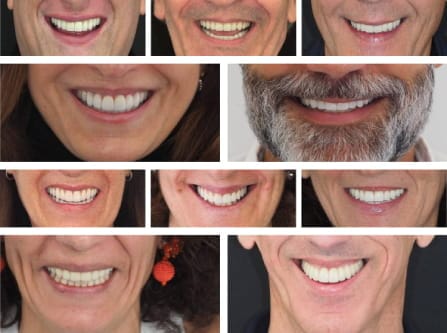Sorrisos dos pacientes
