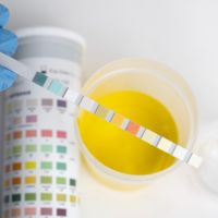 labstix