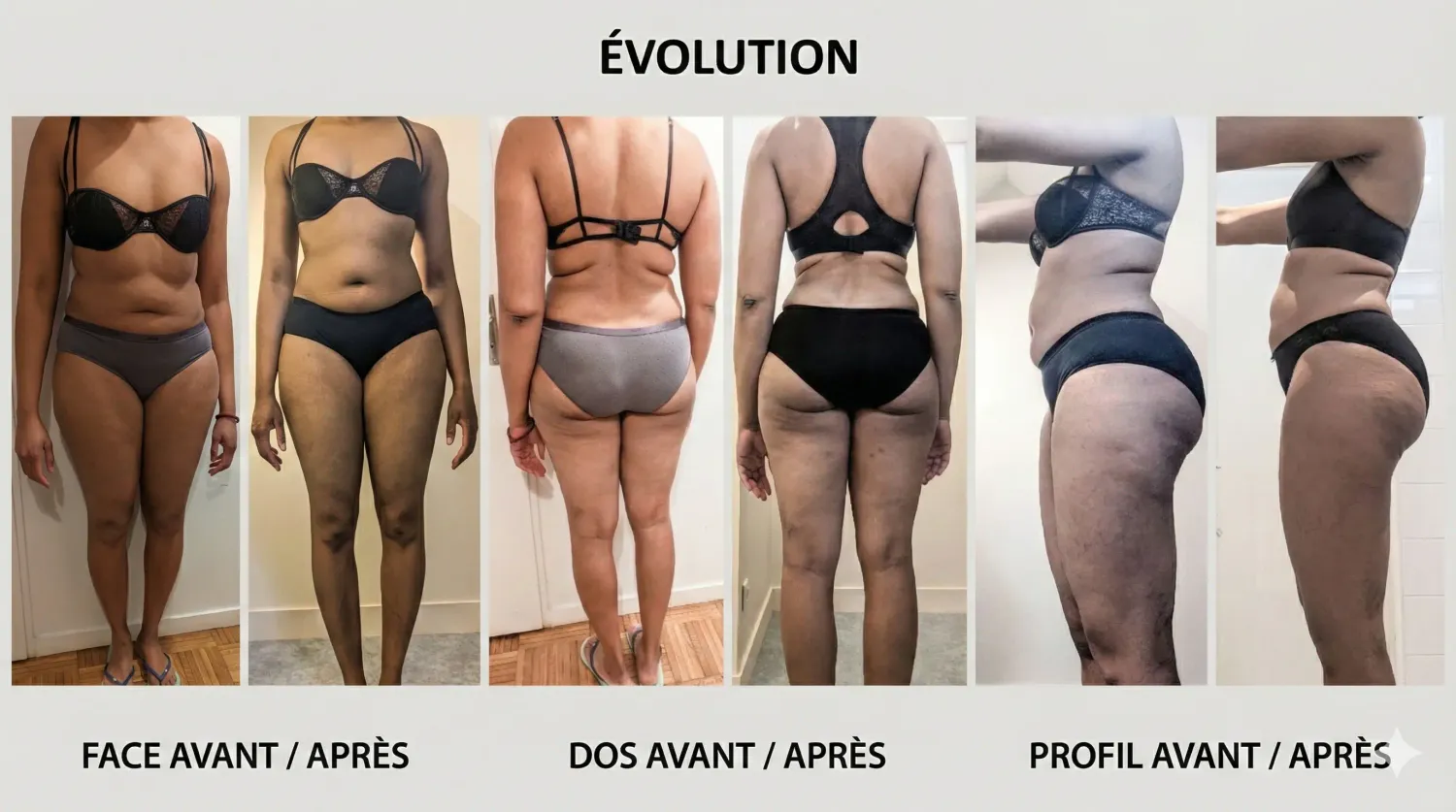 Transformation Diana