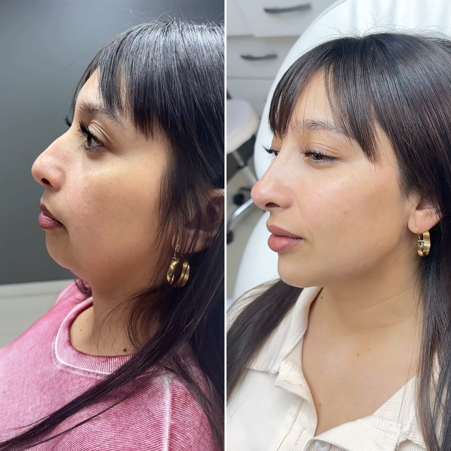 Resultado Full Face 9