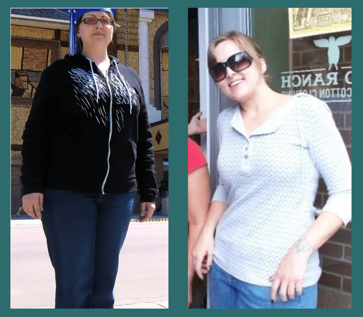 Emily Sioux before and after, stage one