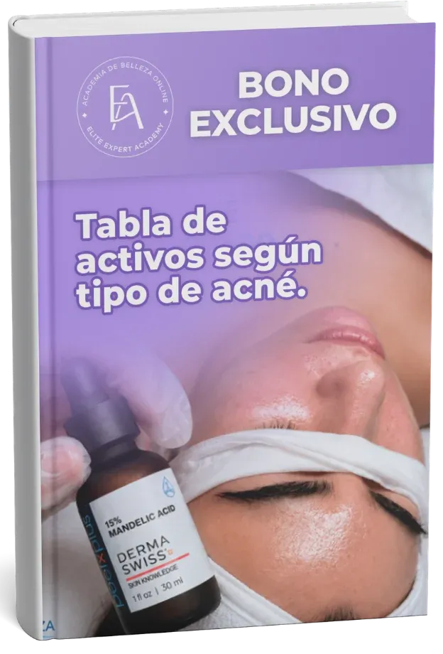 Tabla de activos por tipo de acné
