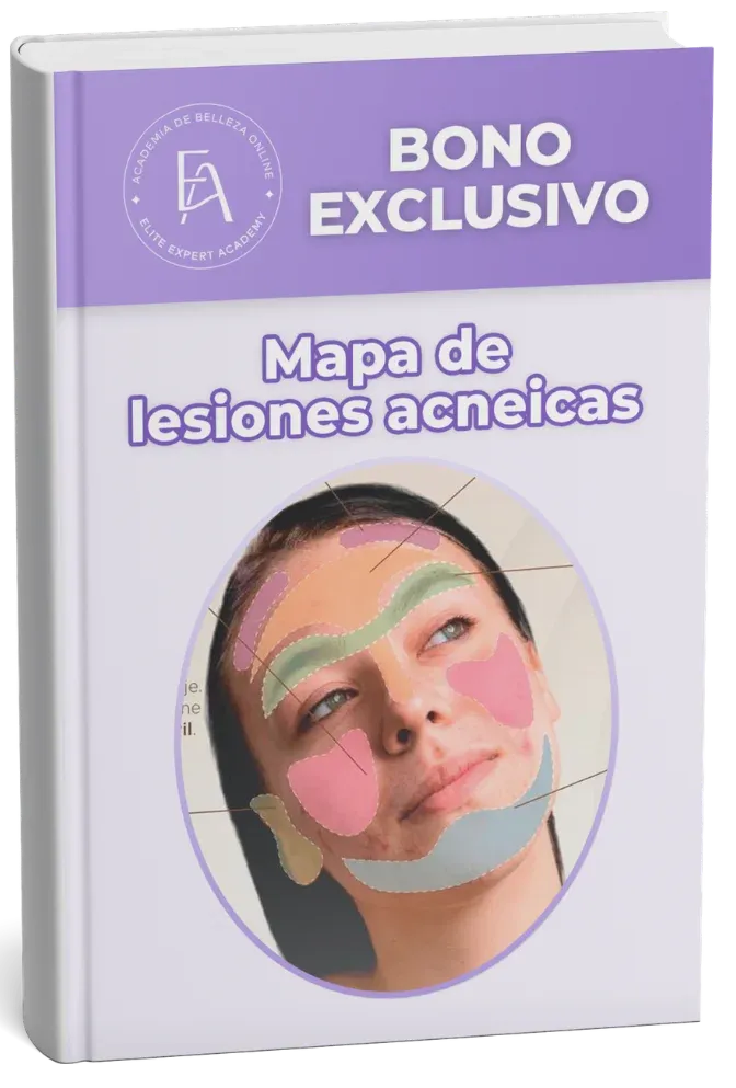 Mapa de lesiones acneicas