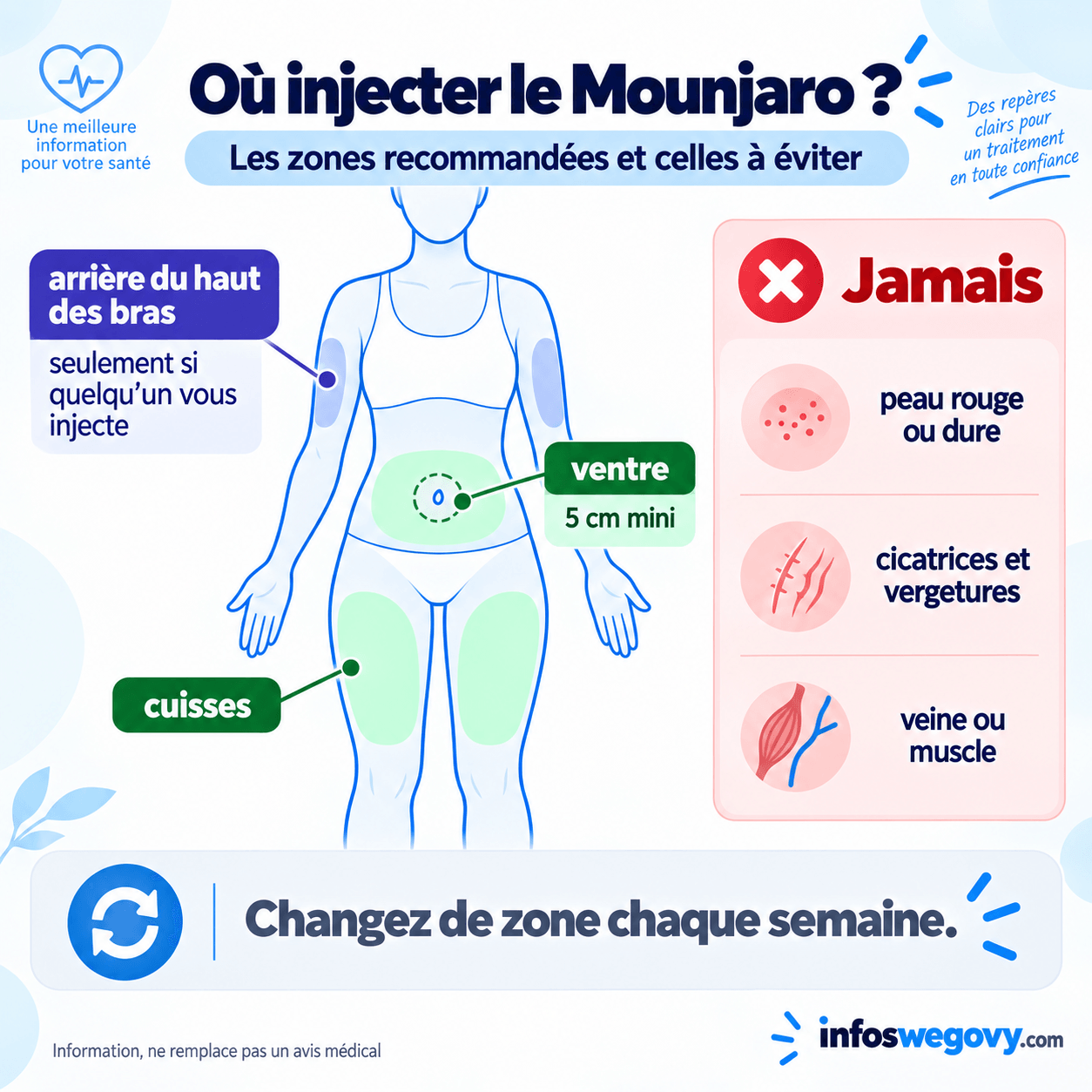 Les zones où injecter le Mounjaro, ventre à cinq centimètres du nombril, cuisses, et arrière du haut du bras uniquement si une autre personne fait l'injection