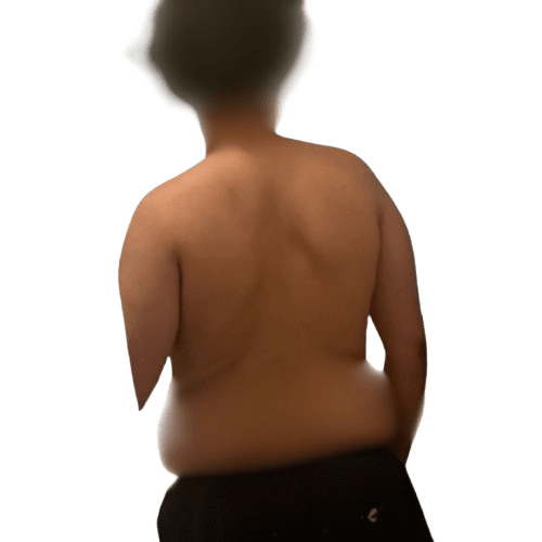 Adam avant 115kg dos