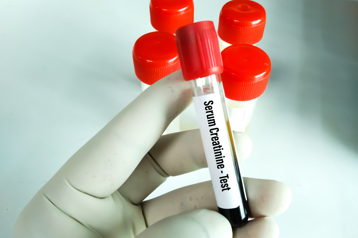 serum creatinine tube