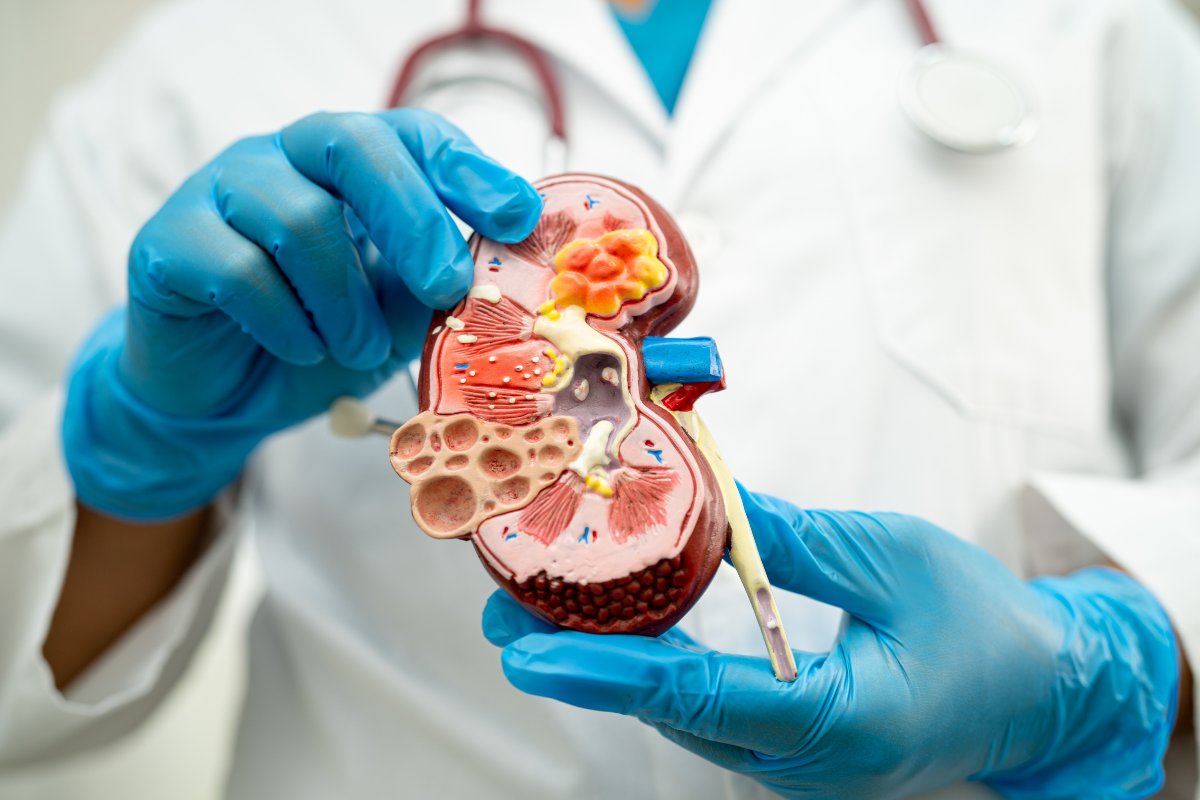 doctor holding kidney