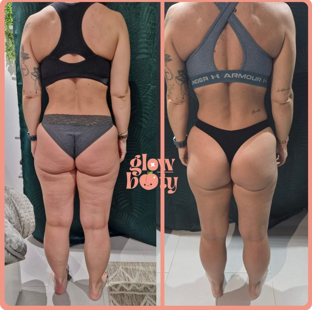 Transformation Glow Booty 04