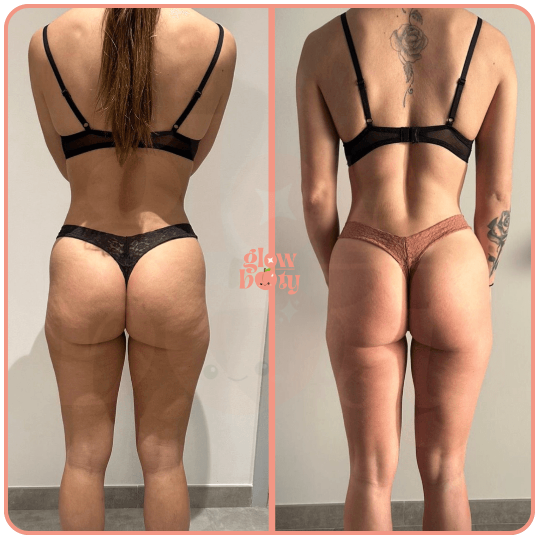 Transformation Glow Booty 07