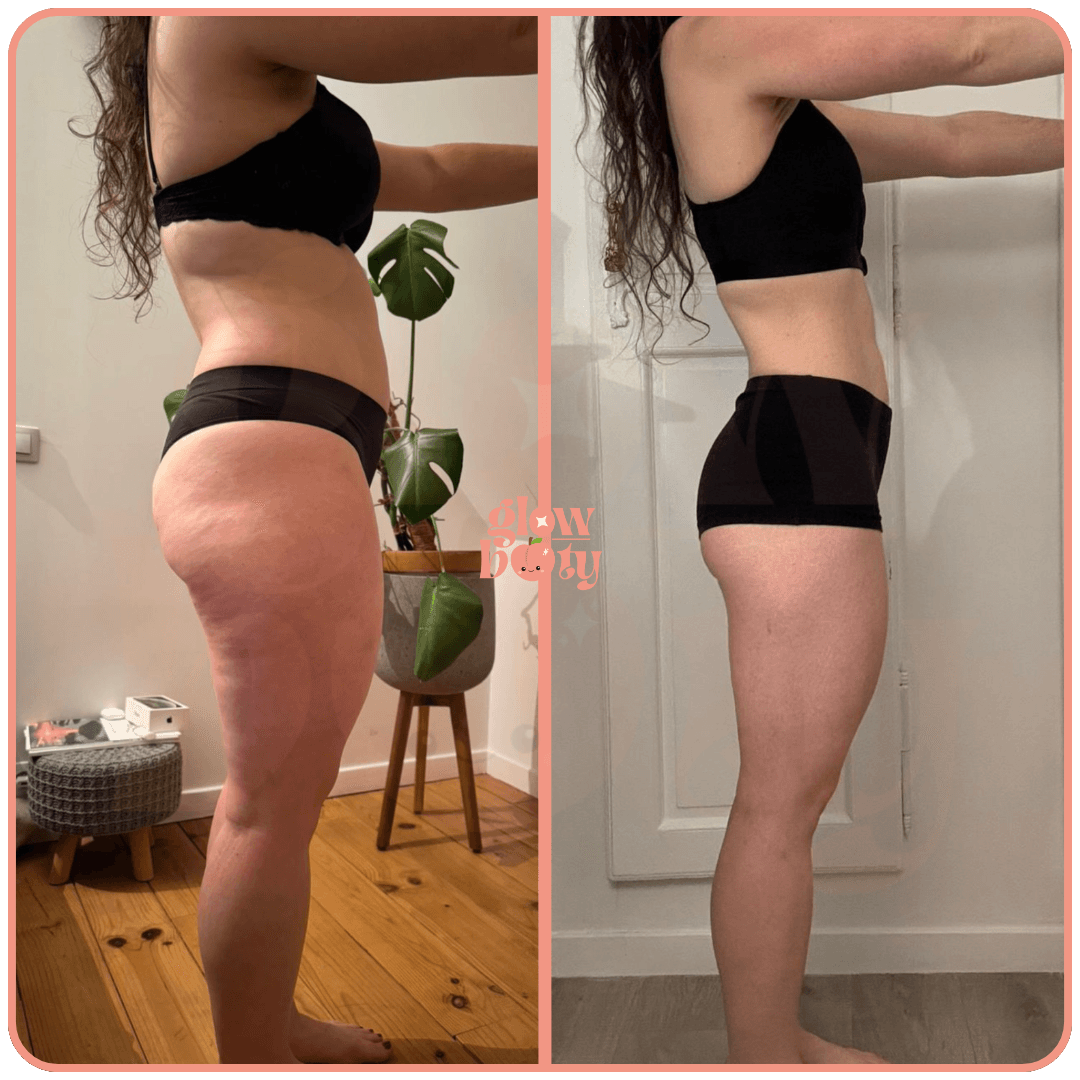 Transformation Glow Booty 10