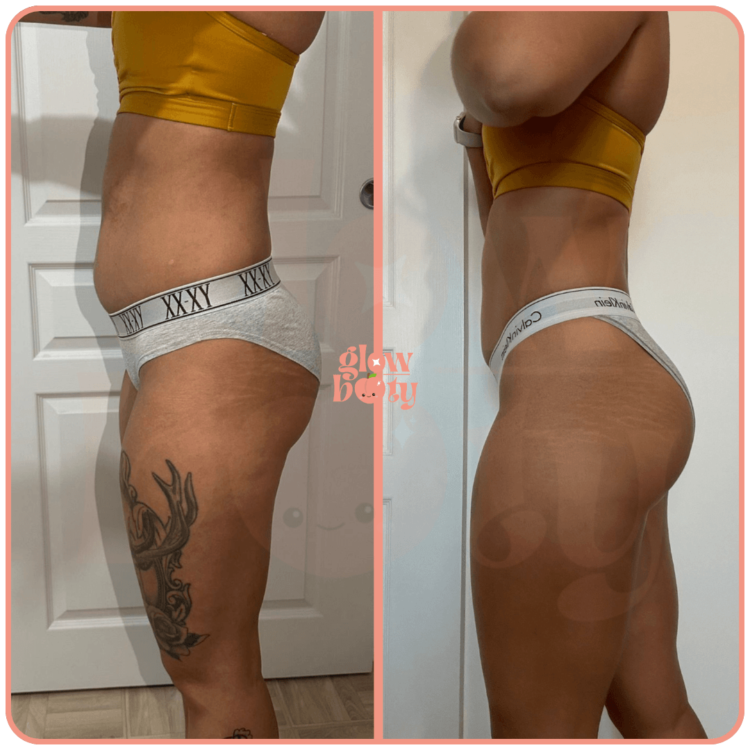 Transformation Glow Booty 13