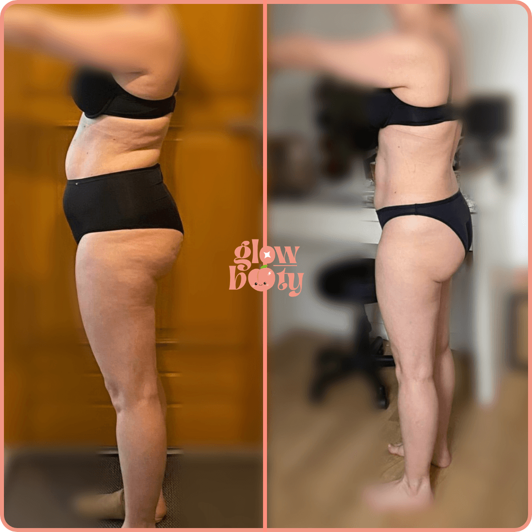 Transformation Glow Booty 16