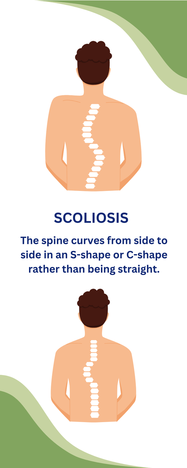 infographic about scoliosis curvature