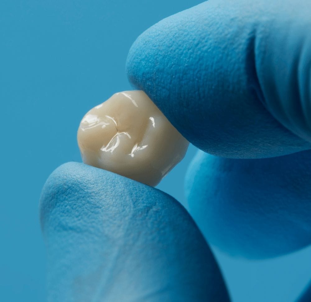 Materiales premium de alta resistencia