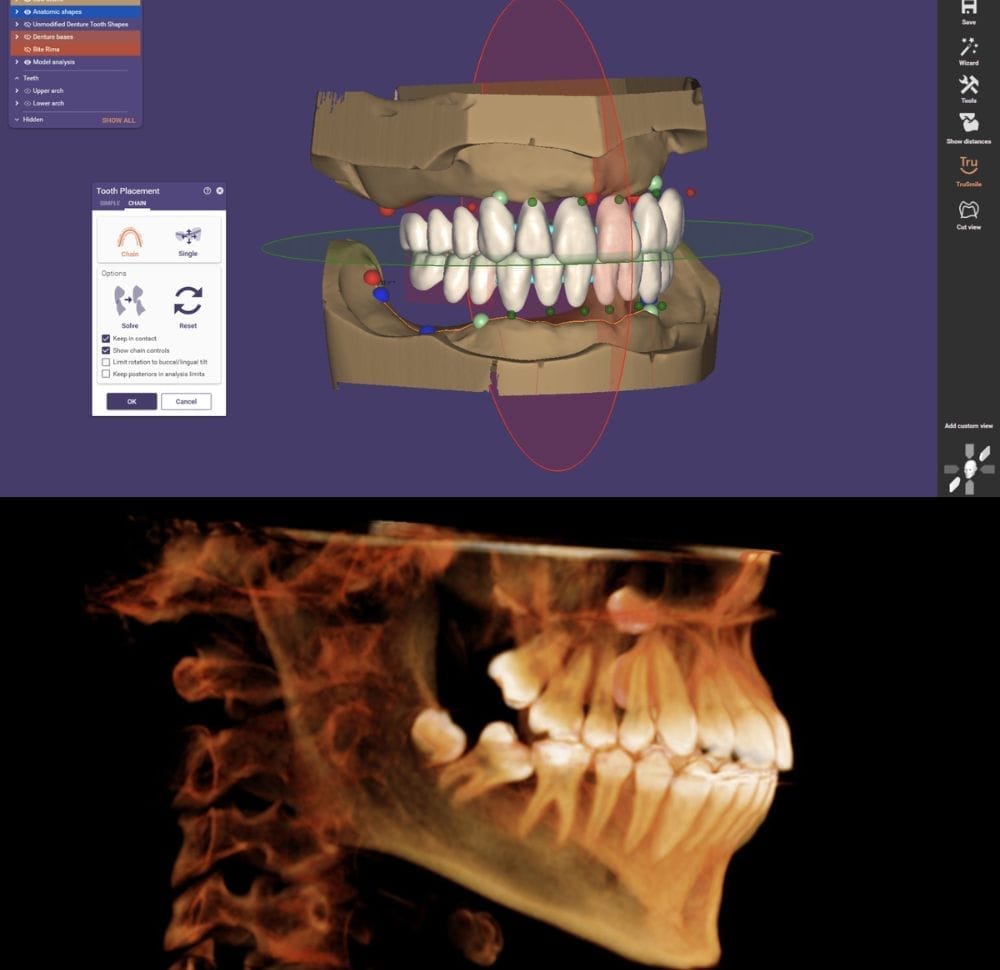 Diagnóstico con tecnología 3D