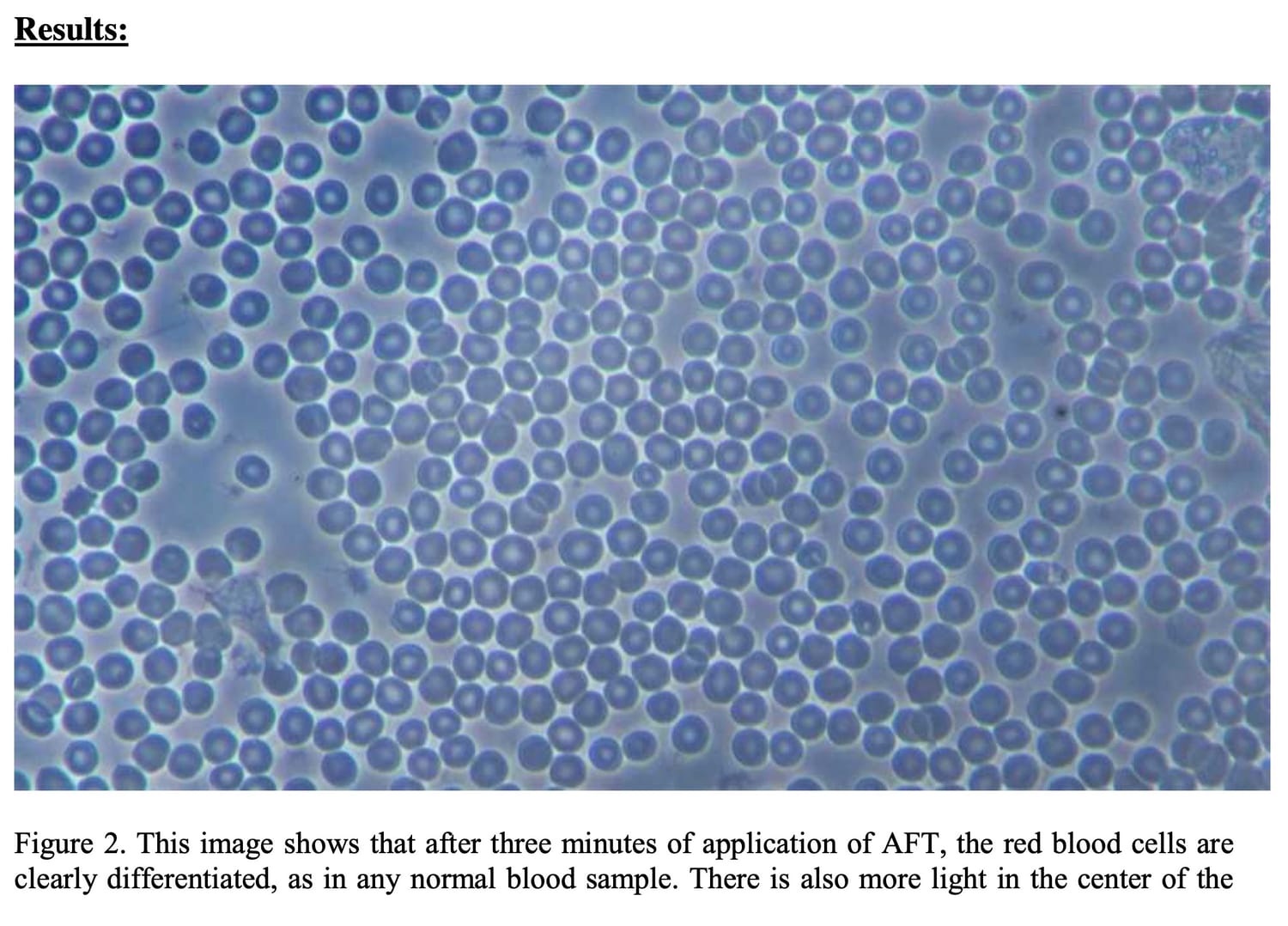 Live Blood After
