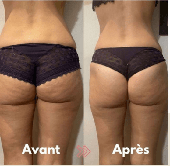 T&eacute;moignage cliente
