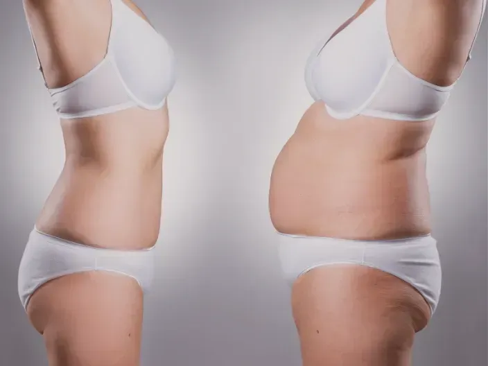 Visual showing how dieting changes gut bacteria and promotes weight regain