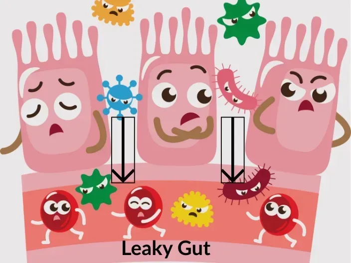Illustration showing leaky gut and immune system activation
