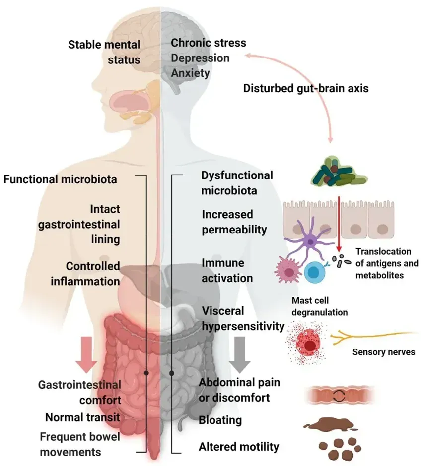 Diagram showing IBS symptoms in the digestive tract