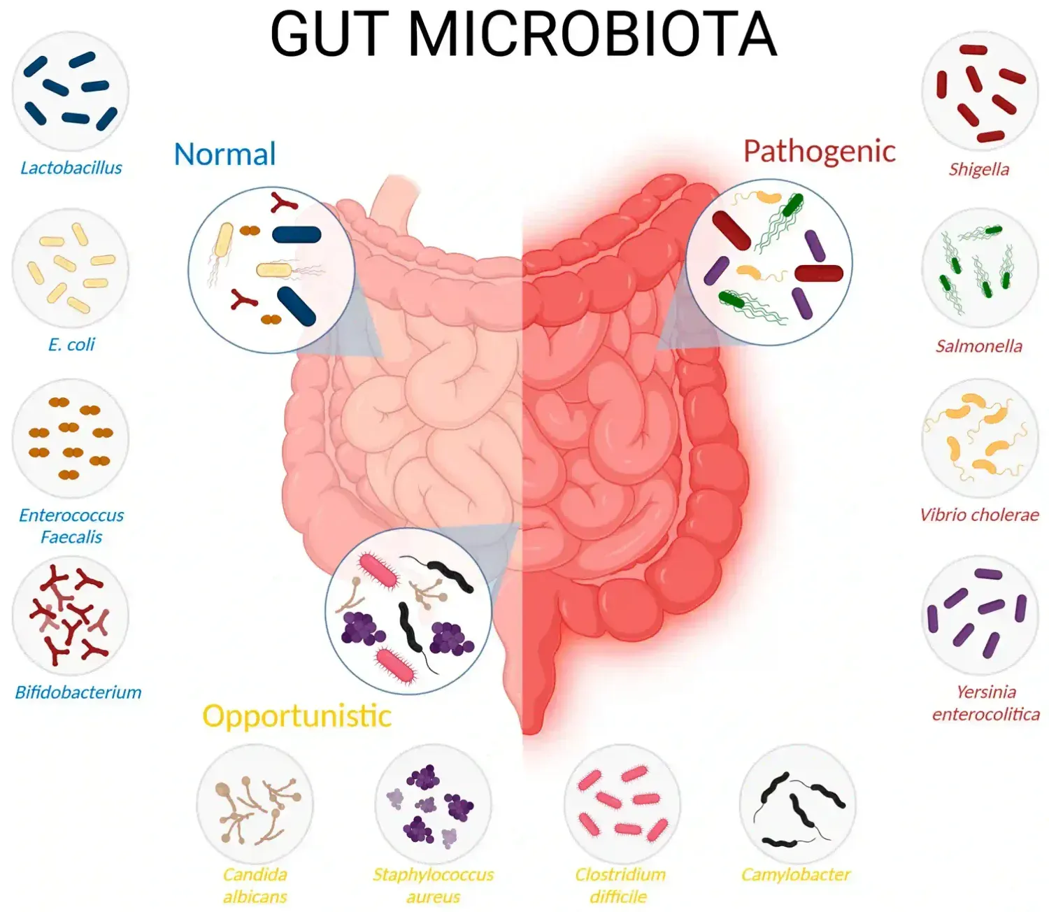 Gut microbiome imbalance illustration showing fewer beneficial bacteria and more inflammatory bacteria linked to rosacea
