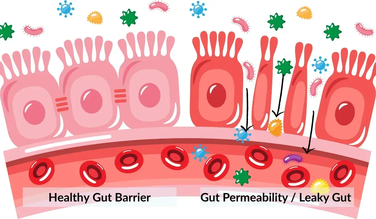 Illustration of gut inflammation and permeability contributing to fatigue