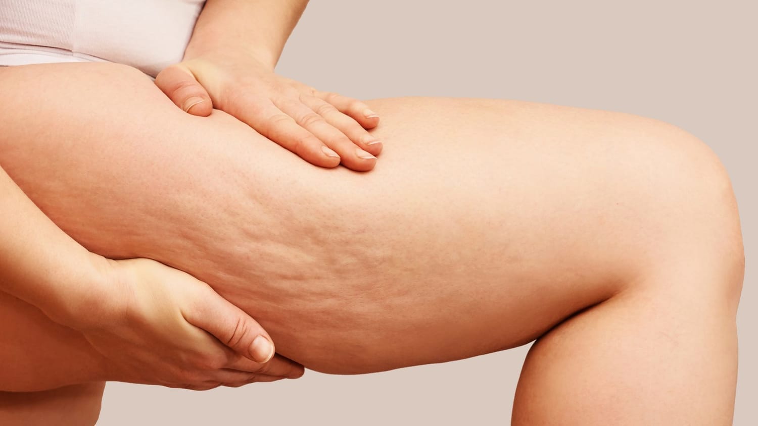 alt="La cellulite n'est pas une fatalité."